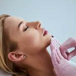lip fillers